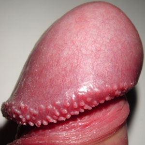 Red bumps on rim of penis
