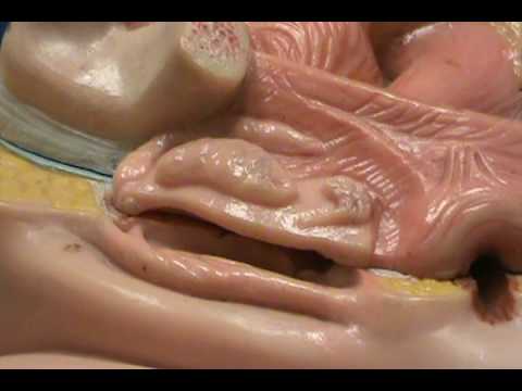 Human deformed sex organs