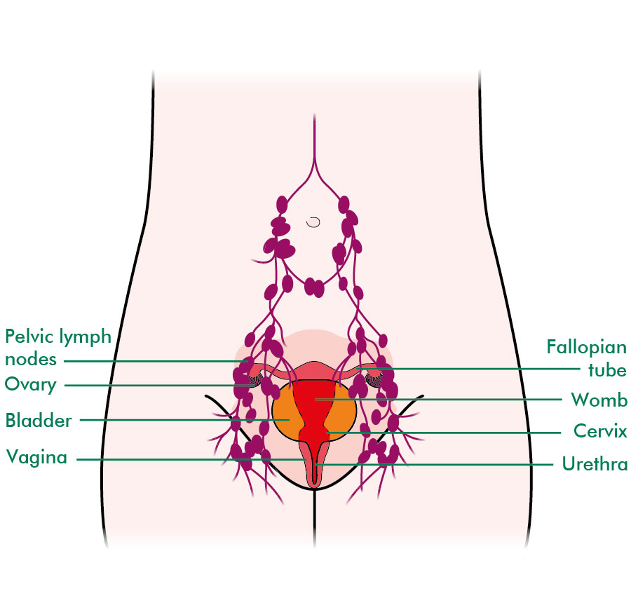 Lymph nodes on vagina